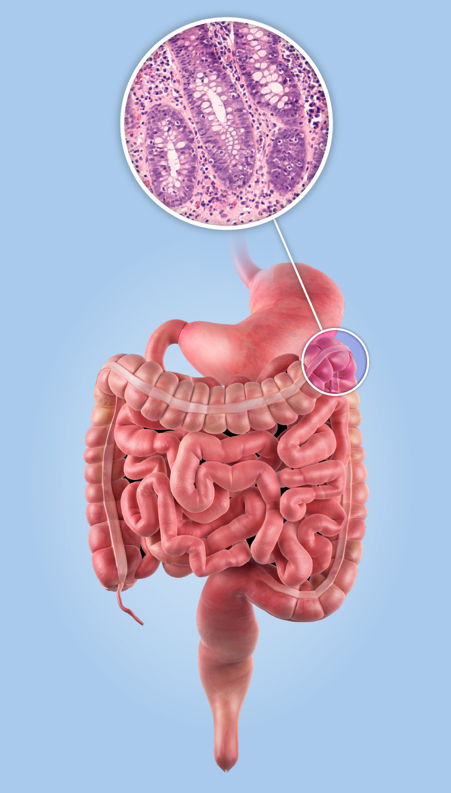 NatSteroidAudit-SideImage-1