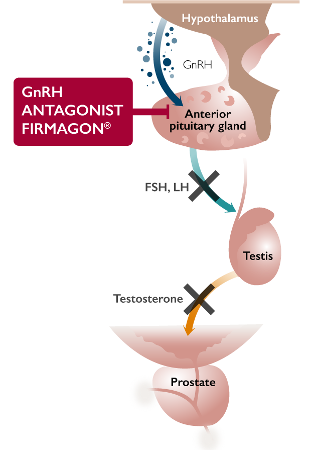 GnRH Antagonist Firmagon®