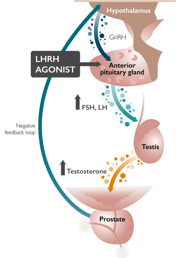 LHRH Agonist