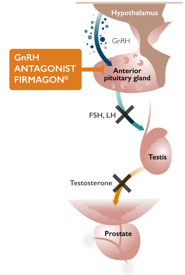 GnRH Antagonist Firmagon®