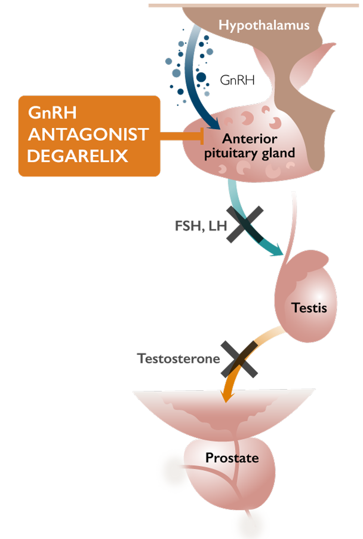 GnRH Antagonist Firmagon®